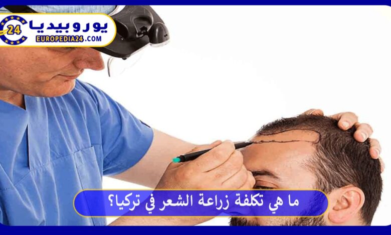 زراعة-الشعر-في-تركيا