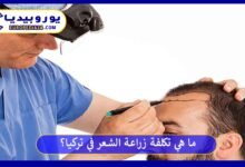 ما هي تكلفة زراعة الشعر في تركيا؟ 109 زراعة-الشعر-في-تركيا