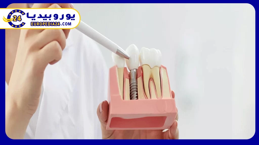 تعرف على مراحل وخطوات زراعة الأسنان في تركيا 2 أنواع التيجان المستخدمة في زراعة الأسنان