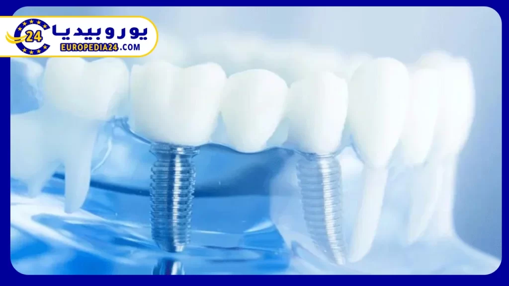 تعرف على مراحل وخطوات زراعة الأسنان في تركيا 3 مكونات الأسنان المزروعة في تركيا