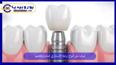 زراعة-الاسنان-في-المانيا