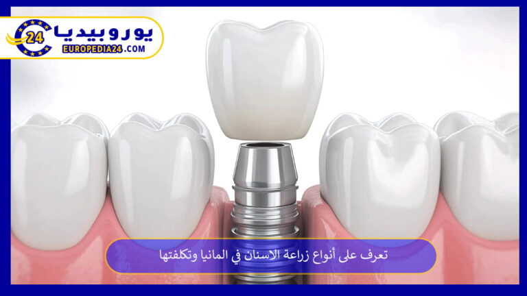 زراعة الاسنان في المانيا